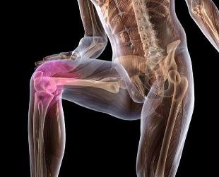 Inflammatioun vum Kniegelenk mat Arthrosis