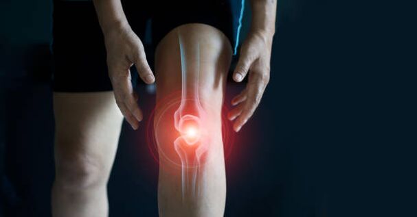Arthrosis vum Knéi Gelenk