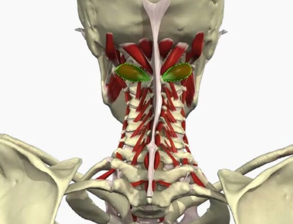 Vertebral Arterie Syndrom